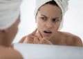7 Lesser-Known Reasons for Acne Breakouts