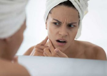 7 Lesser-Known Reasons for Acne Breakouts